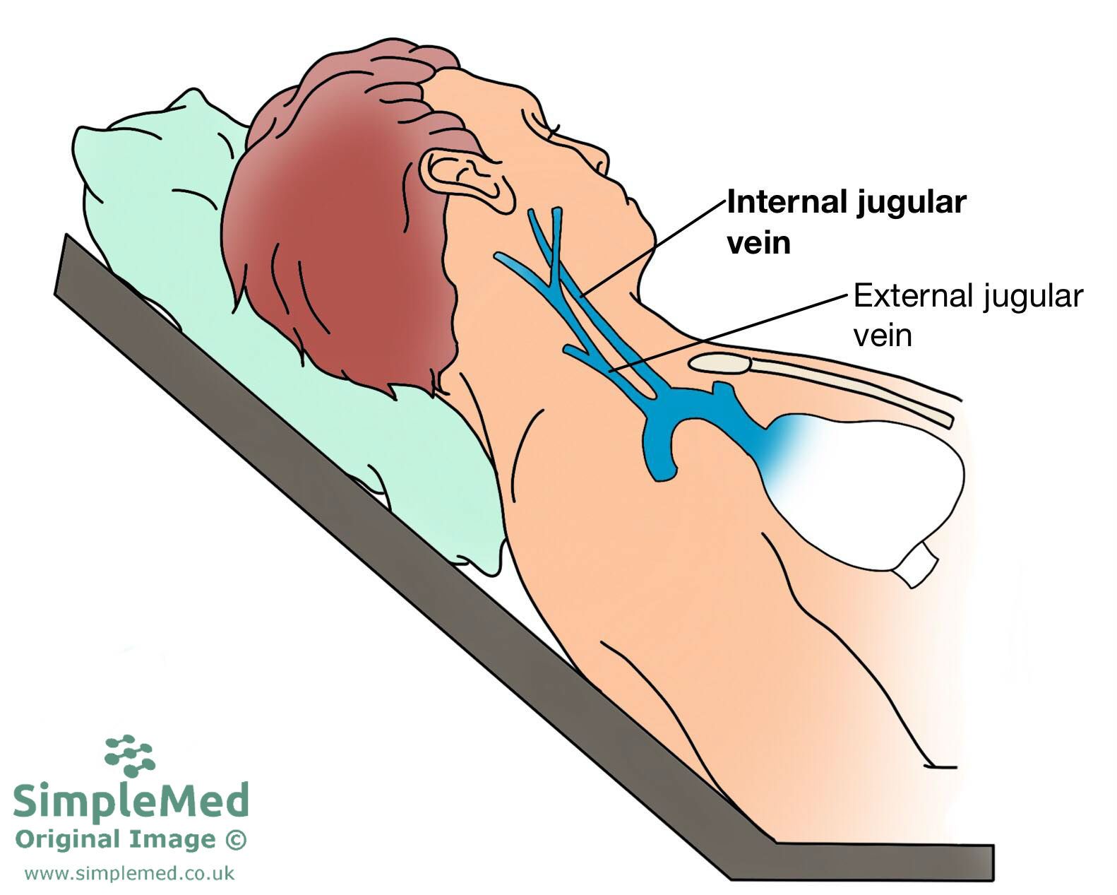 Jugular venous pulse SimpleMed