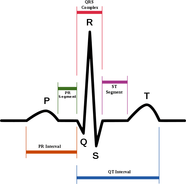 Sinus Rhythm ECG Intervals SimpleMed