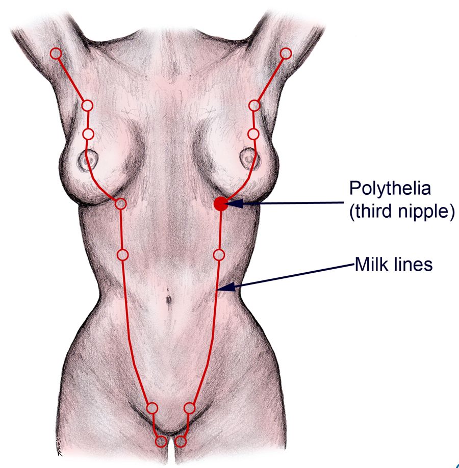 Embryological Mammary Streak/Milk Lines SimpleMed