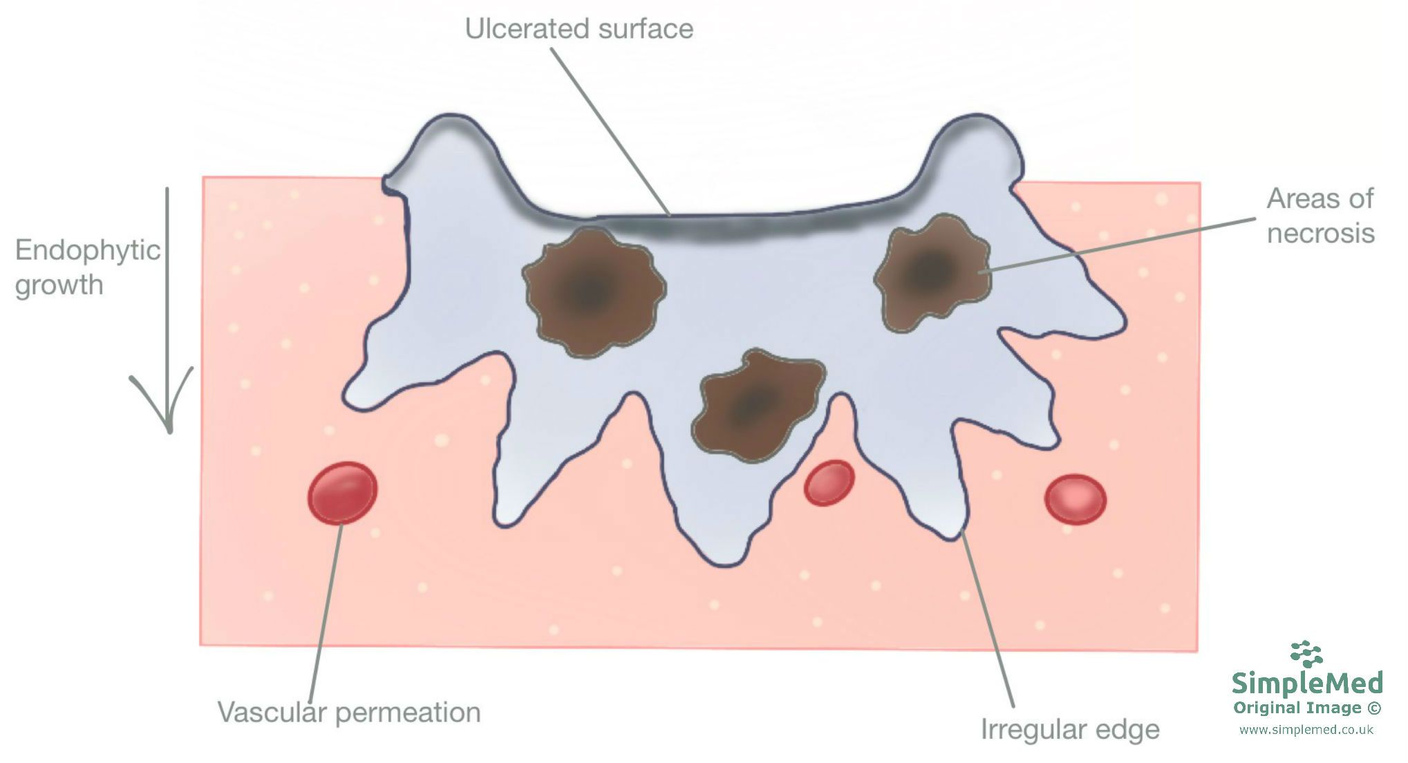 Endophytic Growth SimpleMed 