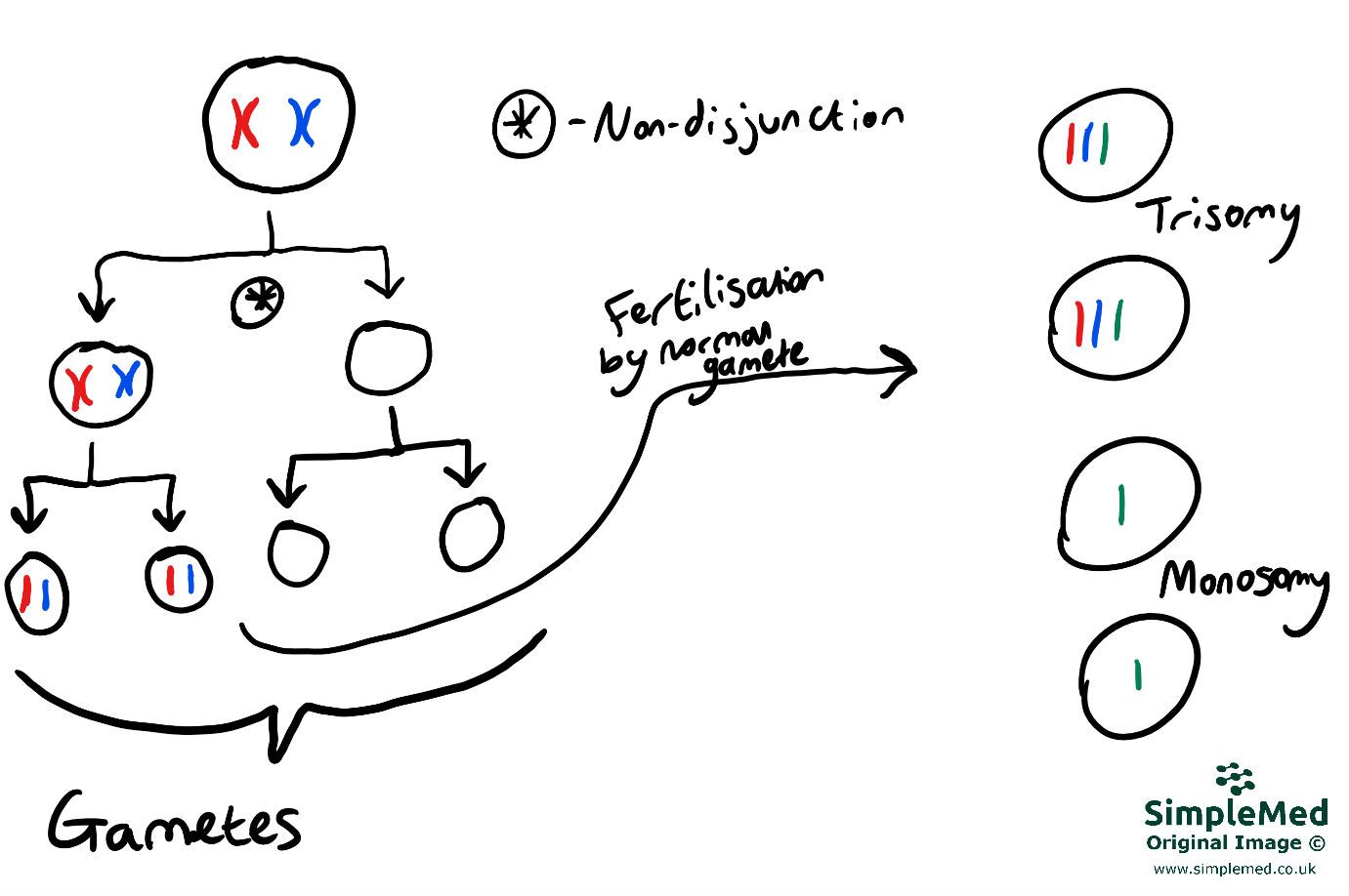 Non-disjunction in Meosis 1 SimpleMed