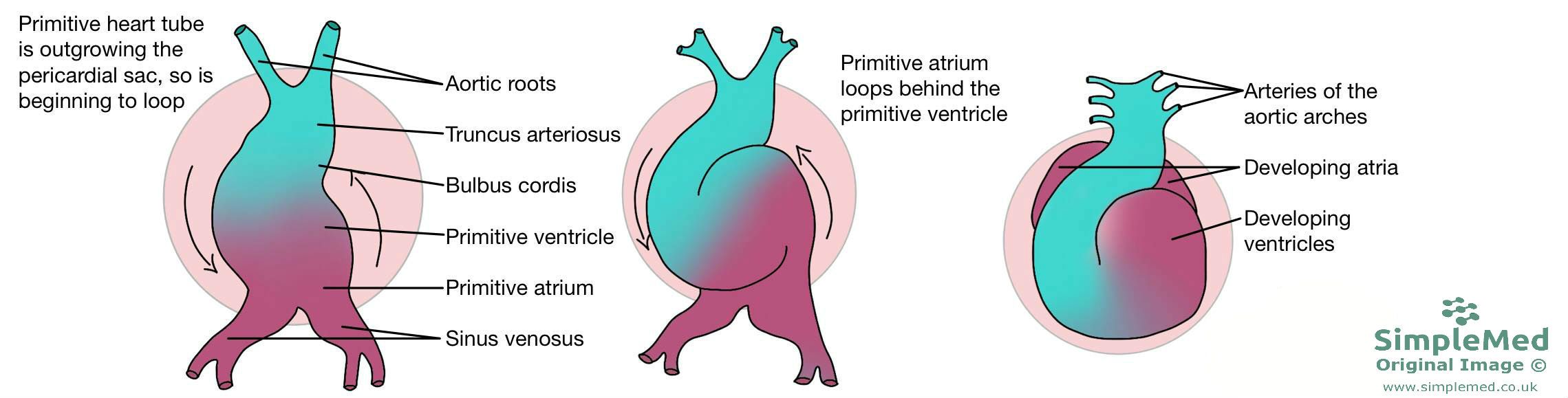 Heart Twisting Embryology SimpleMed