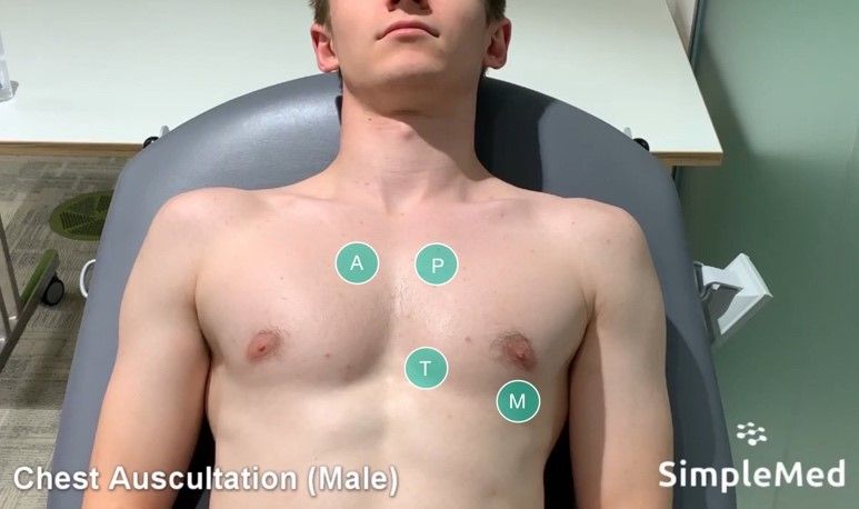 Heart Valve Locations SimpleMed