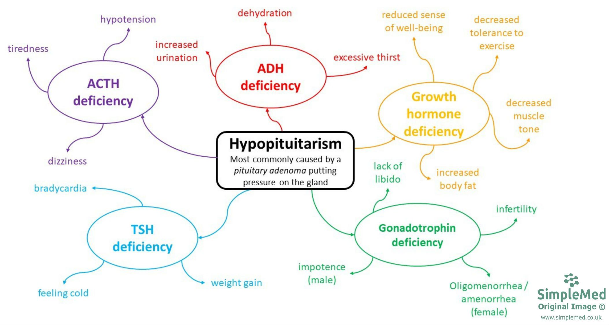 Hypopituitarism Mind-Map SimpleMed