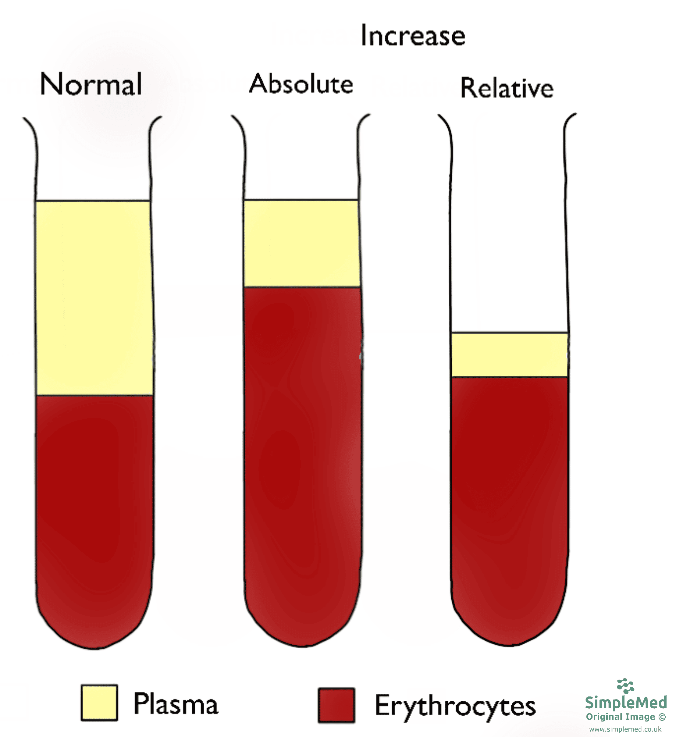 Absolute vs Relative Increase in Haematocrit Levels SimpleMed