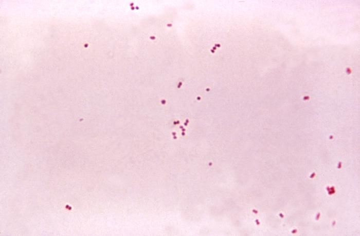 Neisseria Meningitidis Gram Stain SimpleMed