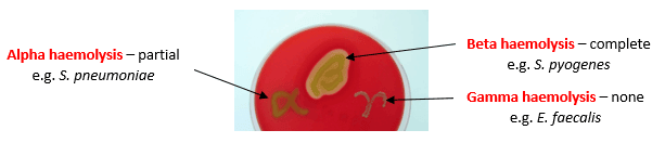 Streptococcal Haemolytic Patterns SimpleMed