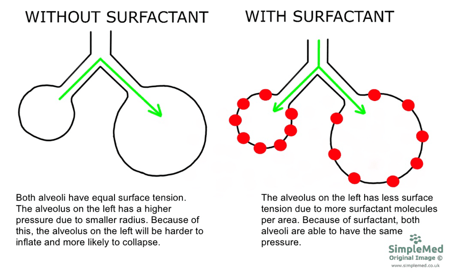 Surfactant Effect on Lung Stabilisation SimpleMed 