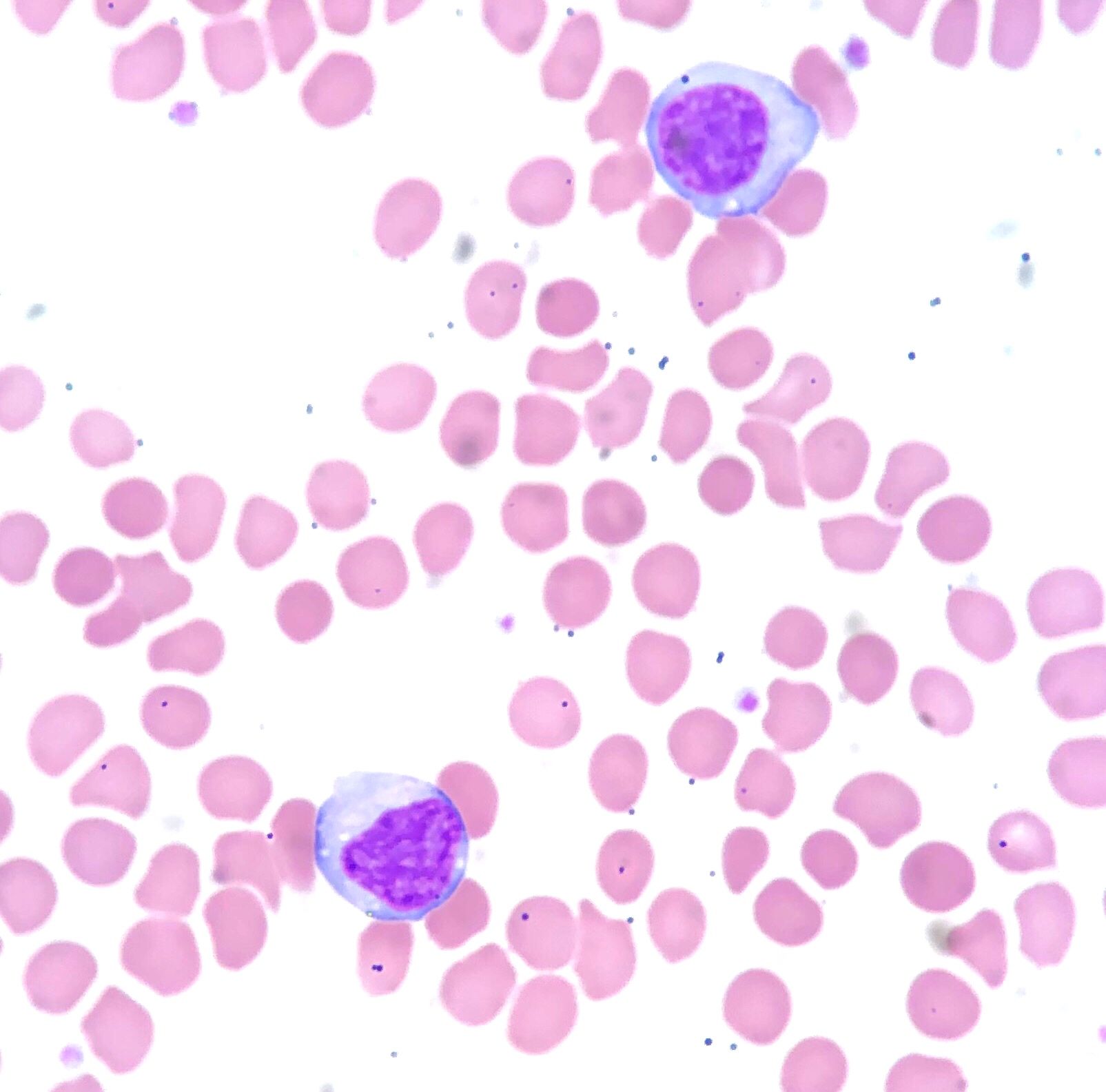 Lymphocyte Histology SimpleMed