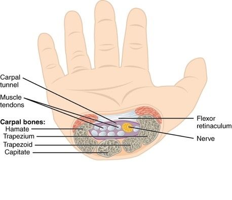 Carpal Tunnel SimpleMed