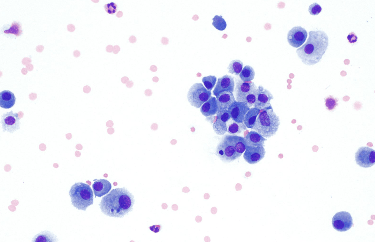 Macrophage Histology SimpleMed