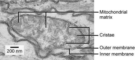 Mitochondria Microscope Labelled SimpleMed