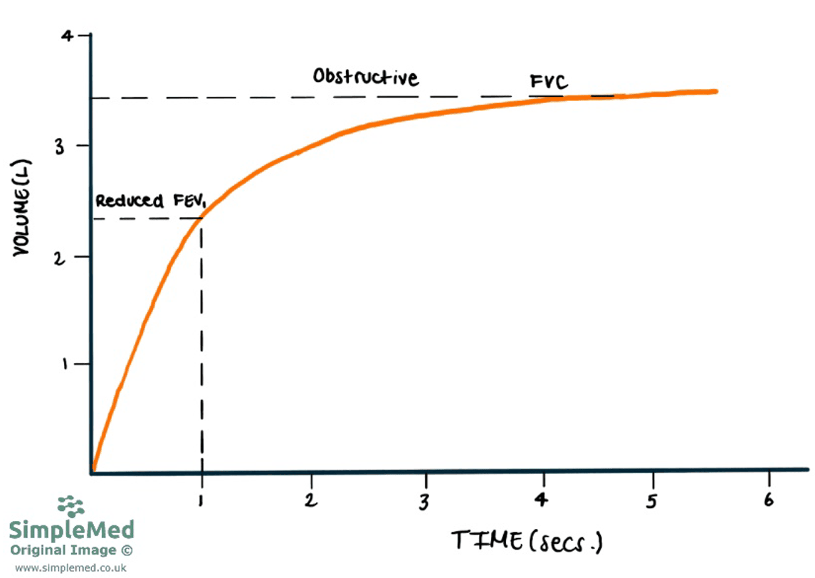 Obstructive Time Volume Graph SimpleMed