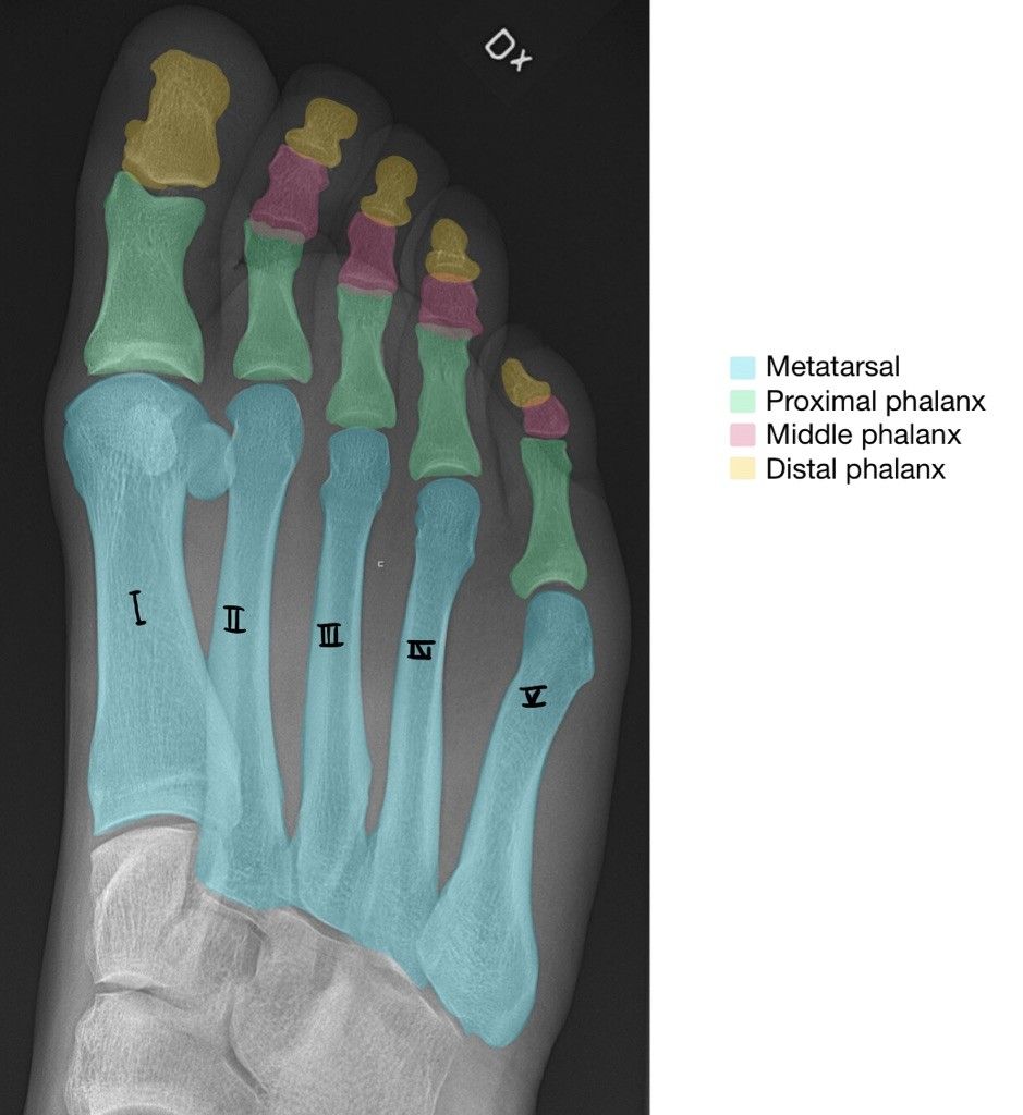 Phalanges Diagram Labelled SimpleMed