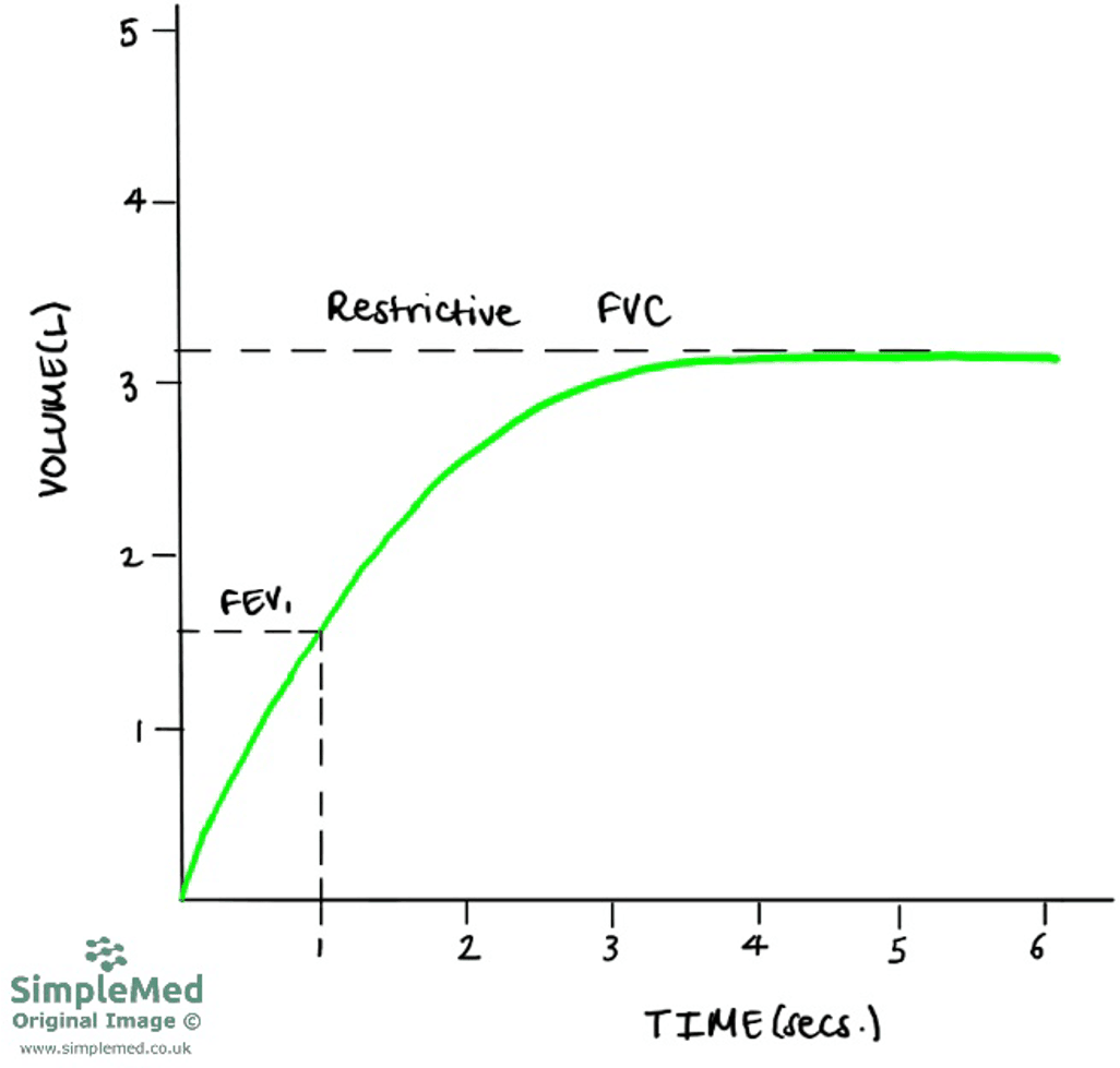 Restrictive Time Volume Graph SimpleMed