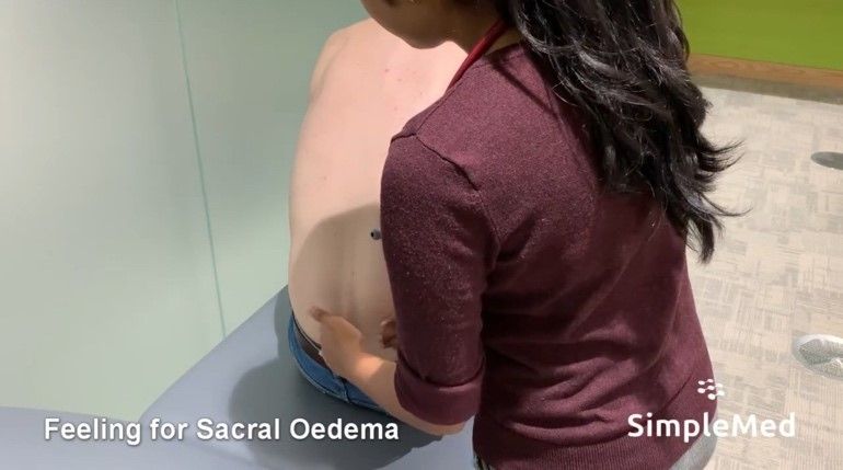 Sacral Oedema SimpleMed