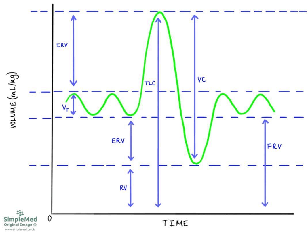 Spirometry Trace SimpleMed