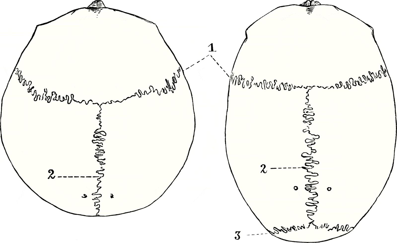 Sutures of the Skull SimpleMed