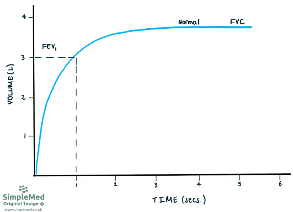 Normal Time Volume Graph SimpleMed