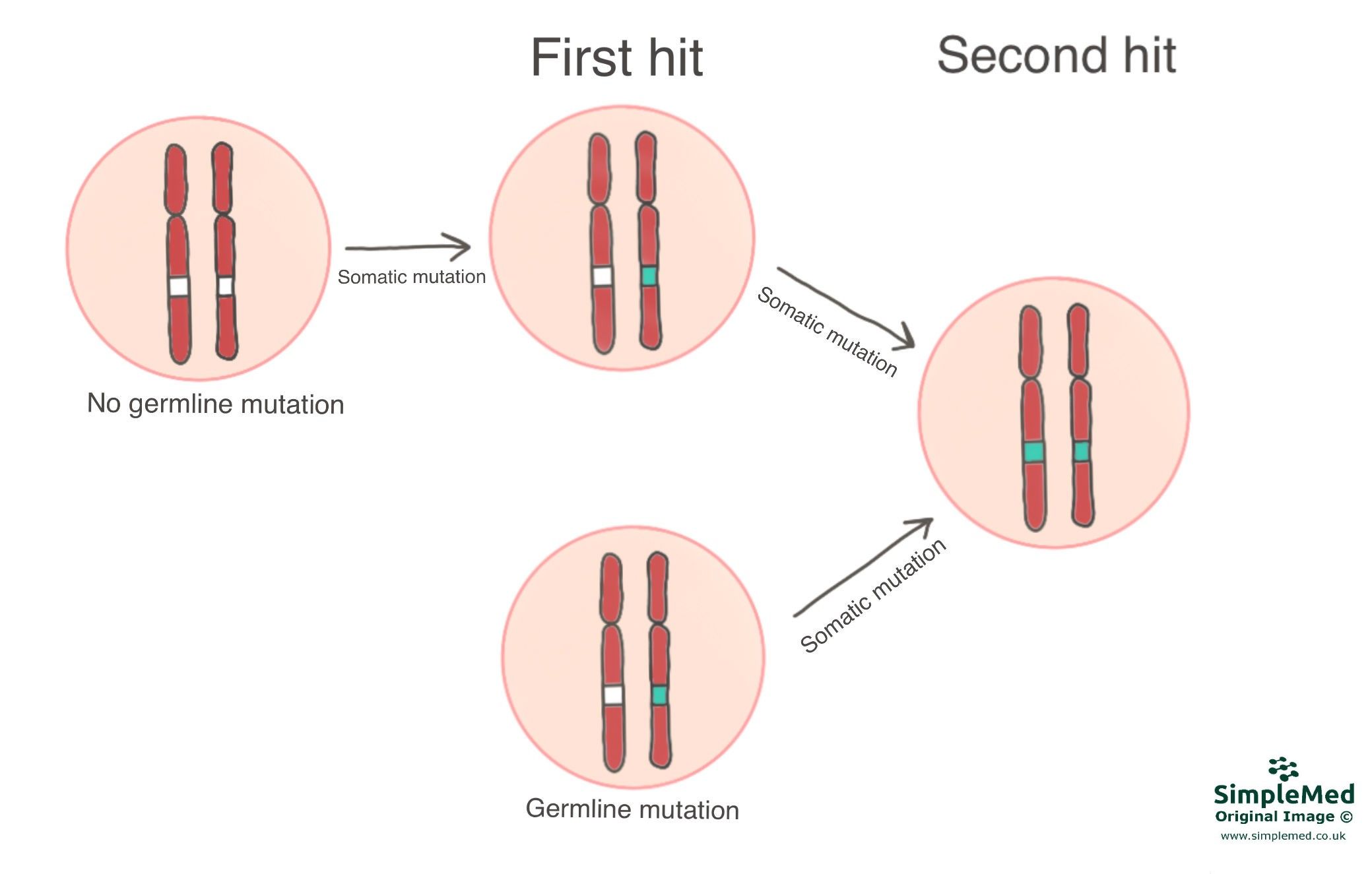 Two Hit Cancer Hypothesis SimpleMed