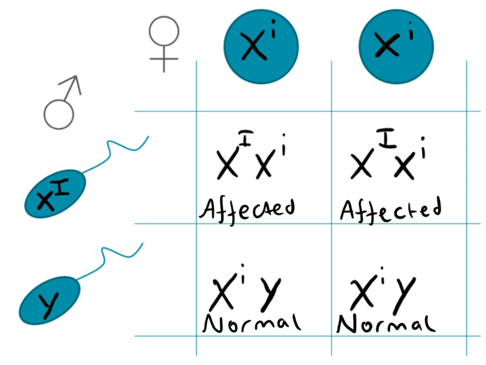 X-Linked Dominant Punnet Square SimpleMed